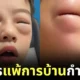 คุณแม่เป็นห่วงหนูน้อยชาวจีนเป็น "โรคแพ้การบ้าน" เริ่มทำทีไร ตาบวมตุ่ยทุกที!