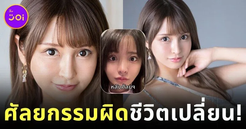 "โนโซมิ ชิราฮามะ (Nozomi Shirahama)" อำลาวงการหนัง AV กะทันหัน เพราะศัลยกรรมทำพิษ