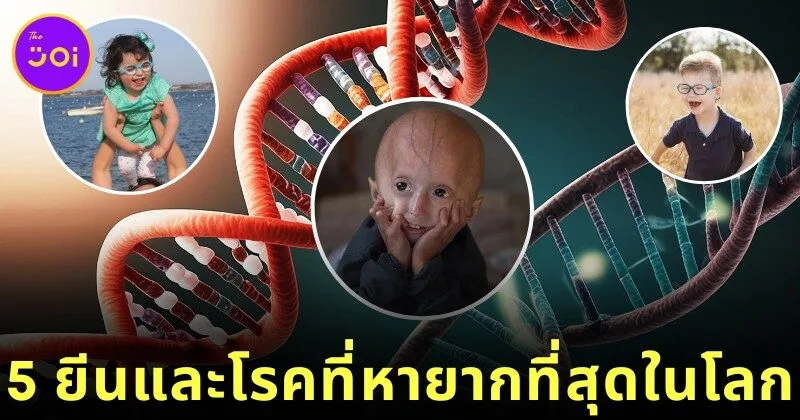 รู้จัก 5 ยีนมนุษย์ที่หายากที่สุดในโลก ความลับของพันธุกรรมที่แทบไม่มีใครเป็น